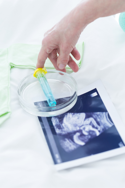 Fertilidad y Reproducción Asistida turismo medico cancun